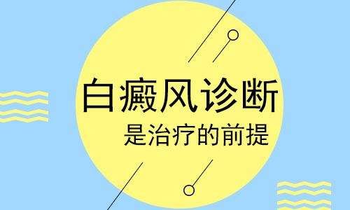 白癜风热点推荐：江西排名前十白癜风医院“重点宣布”白癜风初期怎么诊断?