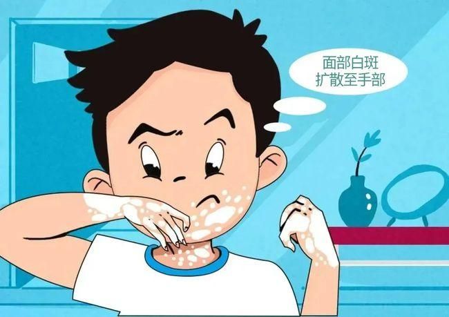 医院排名：南昌治白癜风医院排行公开，不适合白癜风的食物这四种不能吃？