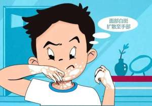 医院排名：南昌治白癜风医院排行公开，不适合白癜风的食物这四种不能吃？