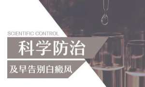 口碑榜:江西南昌治白癜风医院排名,手部白癜风该如何应对?