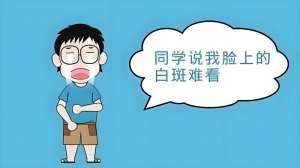重要公布：南昌白癜风医院精选排名，局限性白癜风患者需要注意什么？