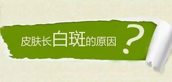 医讯关注！南昌专业治白癜风医院实力排名榜单重磅发布，白癜风的发病原因是什么？