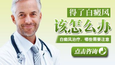 十强官方！南昌儿童面部白癜风排名上榜医院,白点癫风最-好的治疗方案?