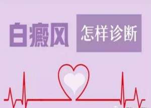 核心推荐：南昌专业白癜风医院精选热榜正式发布，怎样确诊是不是白癜风？