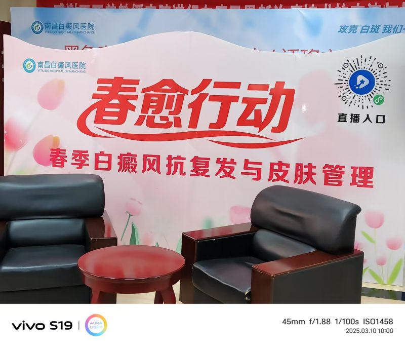 十佳品牌！南昌最-好的白癜风医院-白点癫风最初的症状哪样?
