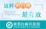 TOP10正规！南昌儿童白癜风专业治疗医院-小孩白癜风怎么治才能断根?